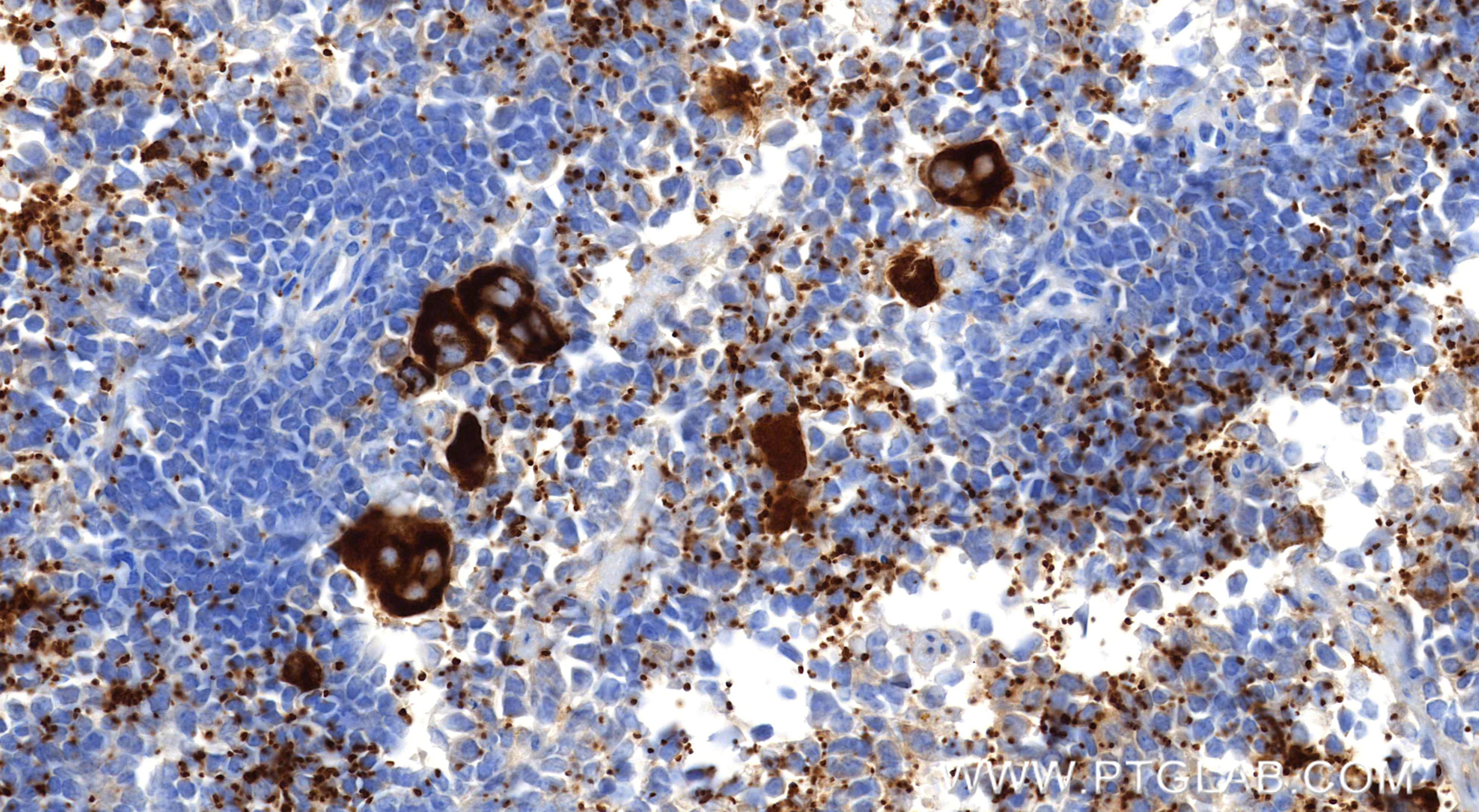 Immunohistochemical analysis of paraffin-embedded mouse spleen tissue slide using 83947-5-RR (P-Selectin/CD62P antibody) at dilution of 1:800 (under 40x lens). Heat mediated antigen retrieval with Tris-EDTA buffer (pH 9.0). Immunohistochemistry (IHC) staining of mouse spleen tissue using P-Selectin/CD62P Recombinant monoclonal antibody (83947-5-RR)