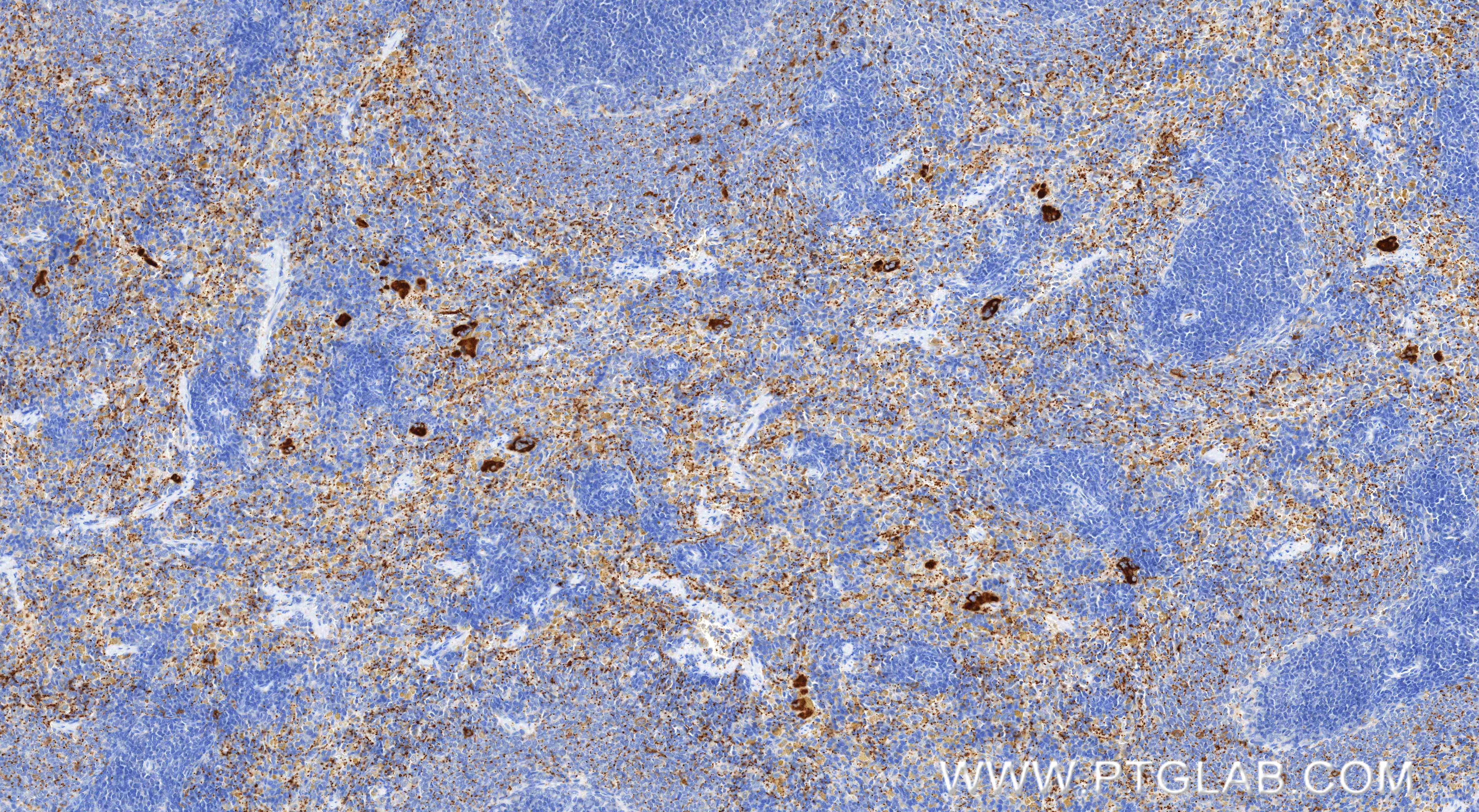 Immunohistochemical analysis of paraffin-embedded rat spleen tissue slide using 83947-5-RR (P-Selectin/CD62P antibody) at dilution of 1:1000 (under 10x lens). Heat mediated antigen retrieval with Tris-EDTA buffer (pH 9.0). Immunohistochemistry (IHC) staining of rat spleen tissue using P-Selectin/CD62P Recombinant monoclonal antibody (83947-5-RR)