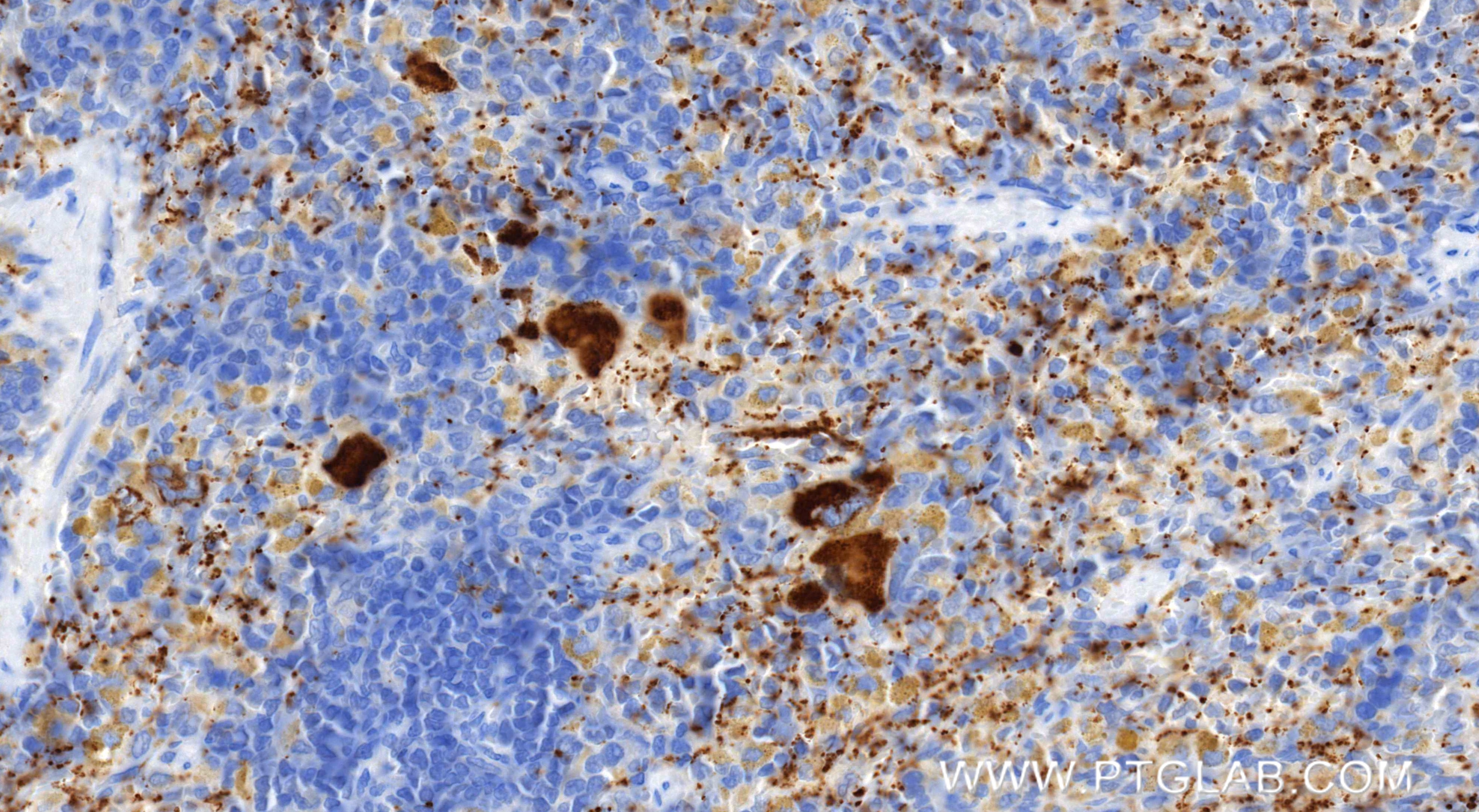 Immunohistochemical analysis of paraffin-embedded rat spleen tissue slide using 83947-5-RR (P-Selectin/CD62P antibody) at dilution of 1:1000 (under 40x lens). Heat mediated antigen retrieval with Tris-EDTA buffer (pH 9.0). Immunohistochemistry (IHC) staining of rat spleen tissue using P-Selectin/CD62P Recombinant monoclonal antibody (83947-5-RR)