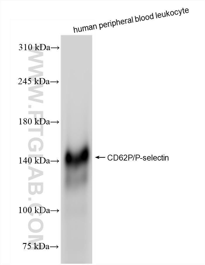 Western Blot (WB) analysis of human peripheral blood leukocyte using P-Selectin/CD62P Recombinant antibody (83947-5-RR)