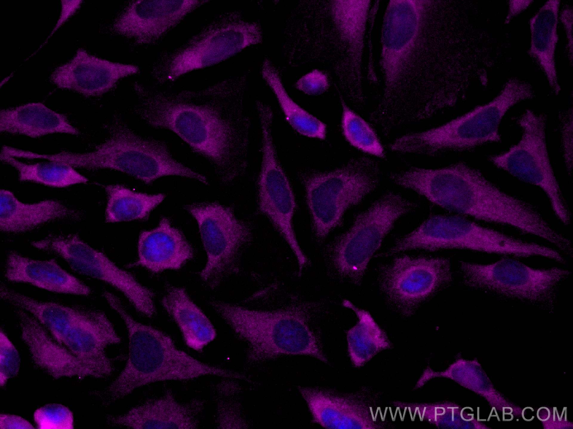 Immunofluorescence (IF) / fluorescent staining of HeLa cells using CoraLite® Plus 647-conjugated Septin 11 Polyclonal (CL647-14672)