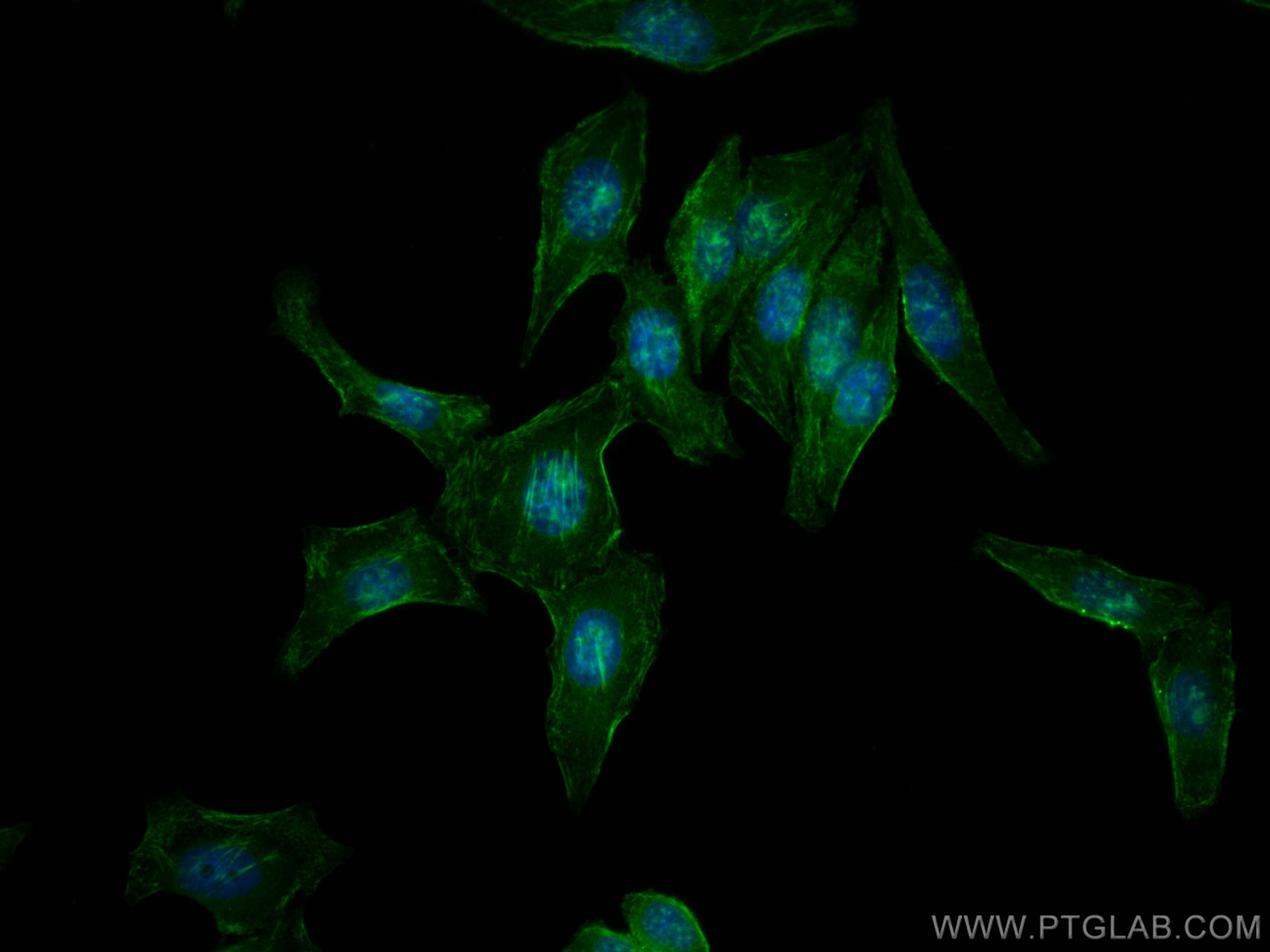 Immunofluorescence (IF) / fluorescent staining of HepG2 cells using CoraLite® Plus 488-conjugated Septin 2 Polyclonal  (CL488-11397)