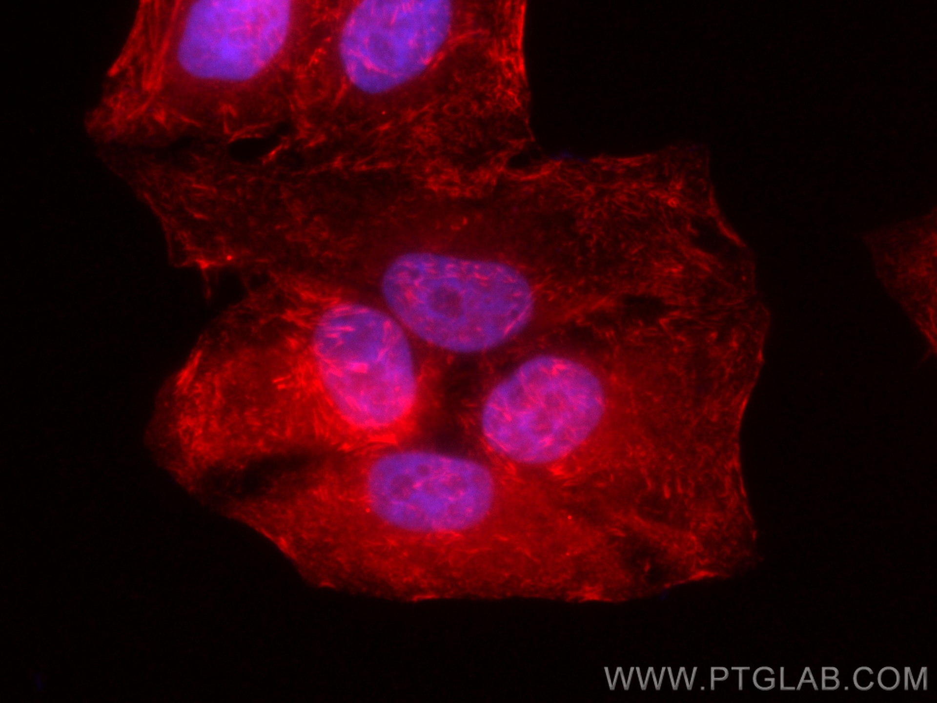 Immunofluorescence (IF) / fluorescent staining of HepG2 cells using CoraLite®594-conjugated Septin 2 Polyclonal antibo (CL594-11397)