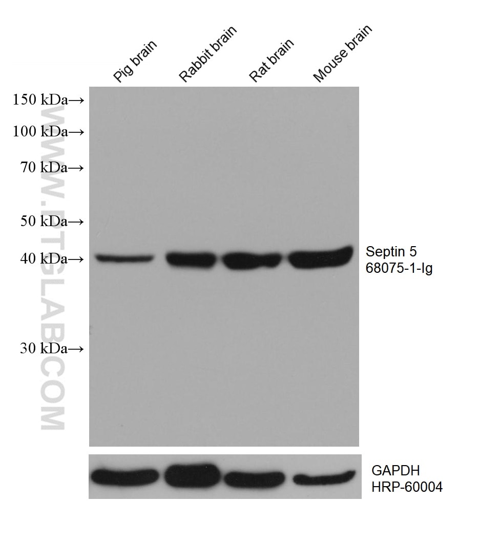 Western Blot (WB) analysis of various lysates using Septin 5 Monoclonal antibody (68075-1-Ig)