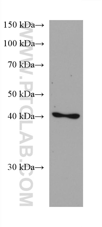 Western Blot (WB) analysis of LNCaP cells using Septin 5 Monoclonal antibody (68075-1-Ig)