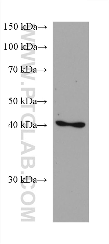 Septin 5