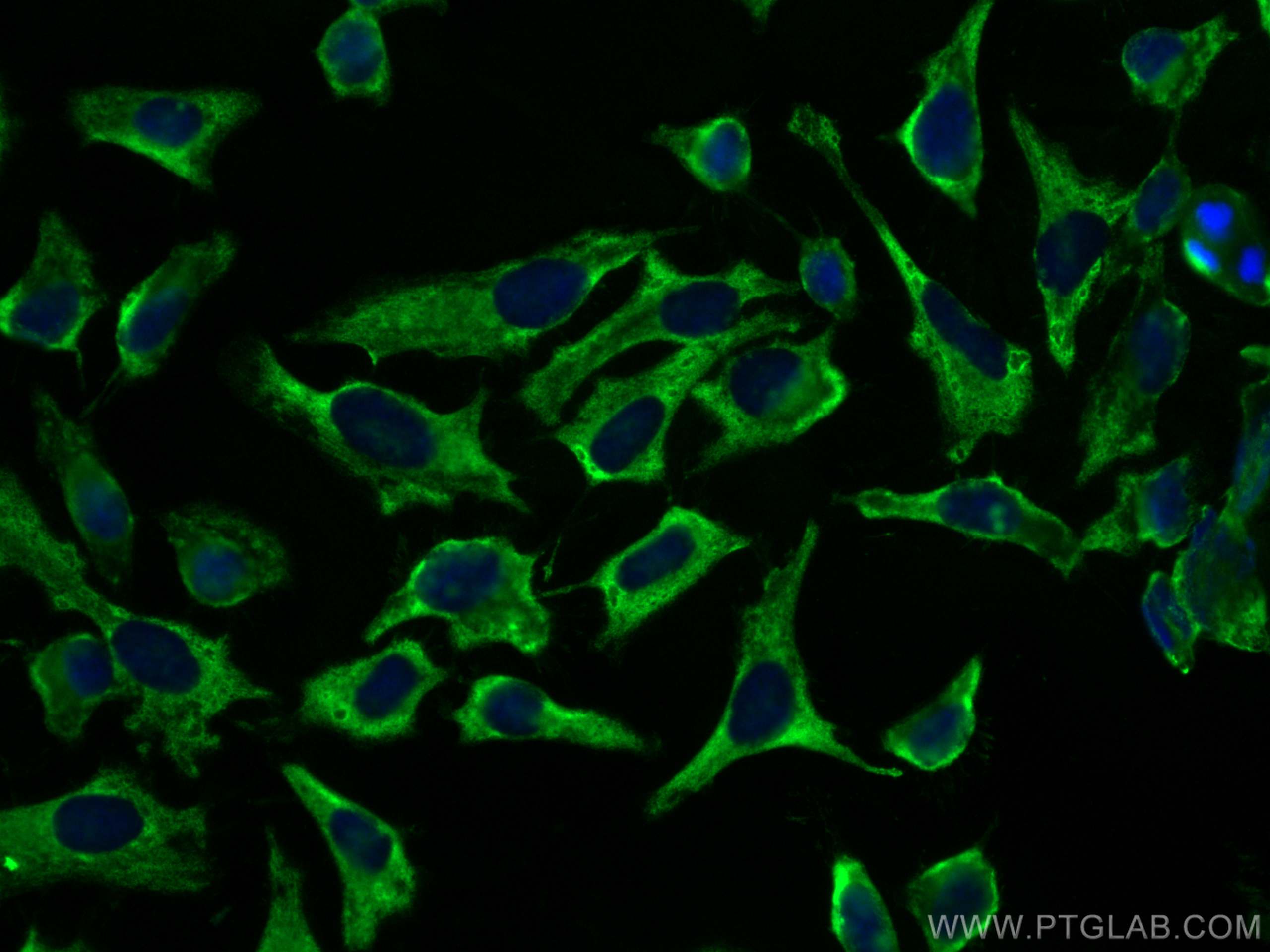 Immunofluorescence (IF) / fluorescent staining of HeLa cells using CoraLite® Plus 488-conjugated Septin 8 Monoclonal  (CL488-66188)