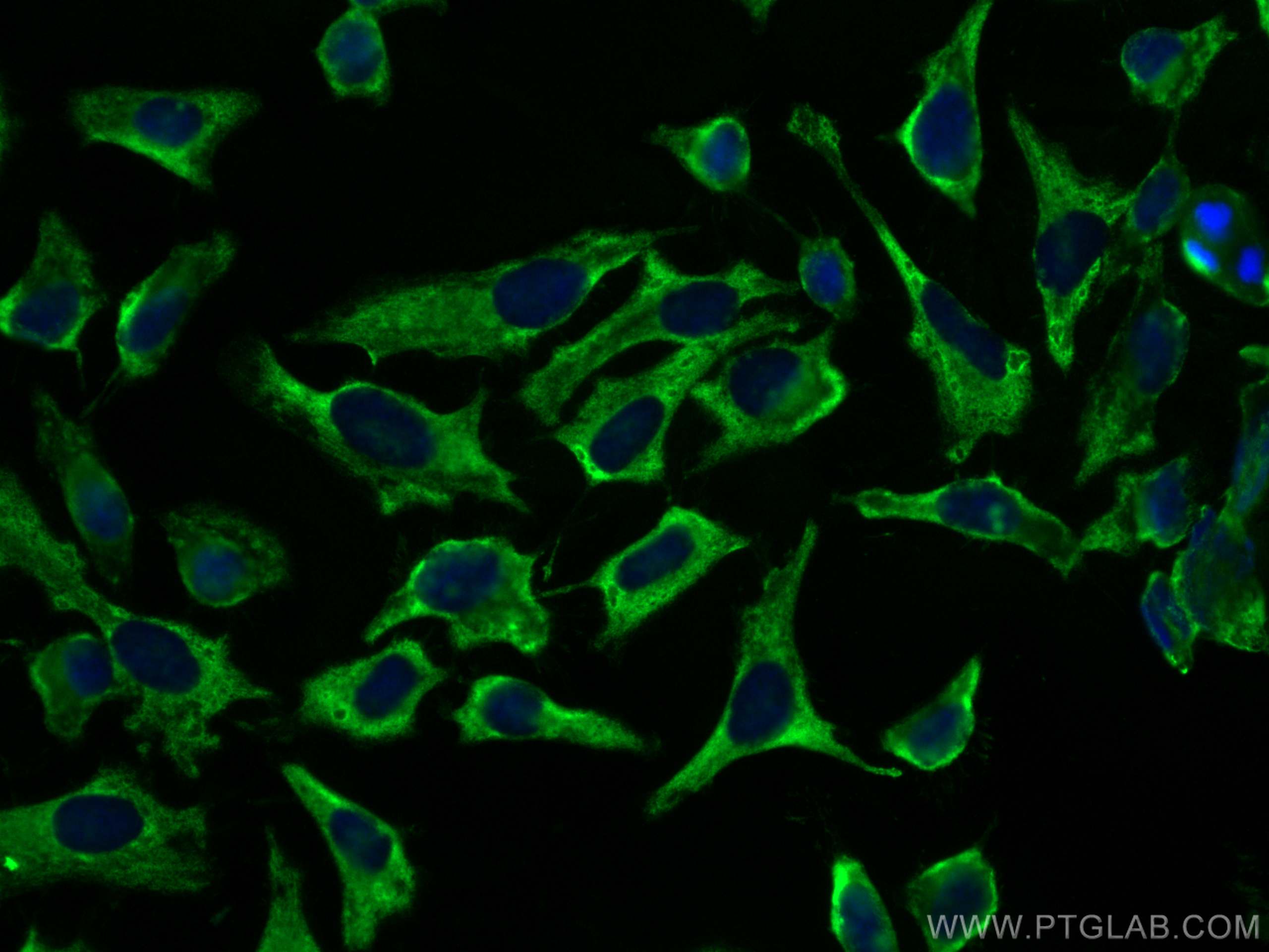 IF Staining of HeLa using CL488-66188