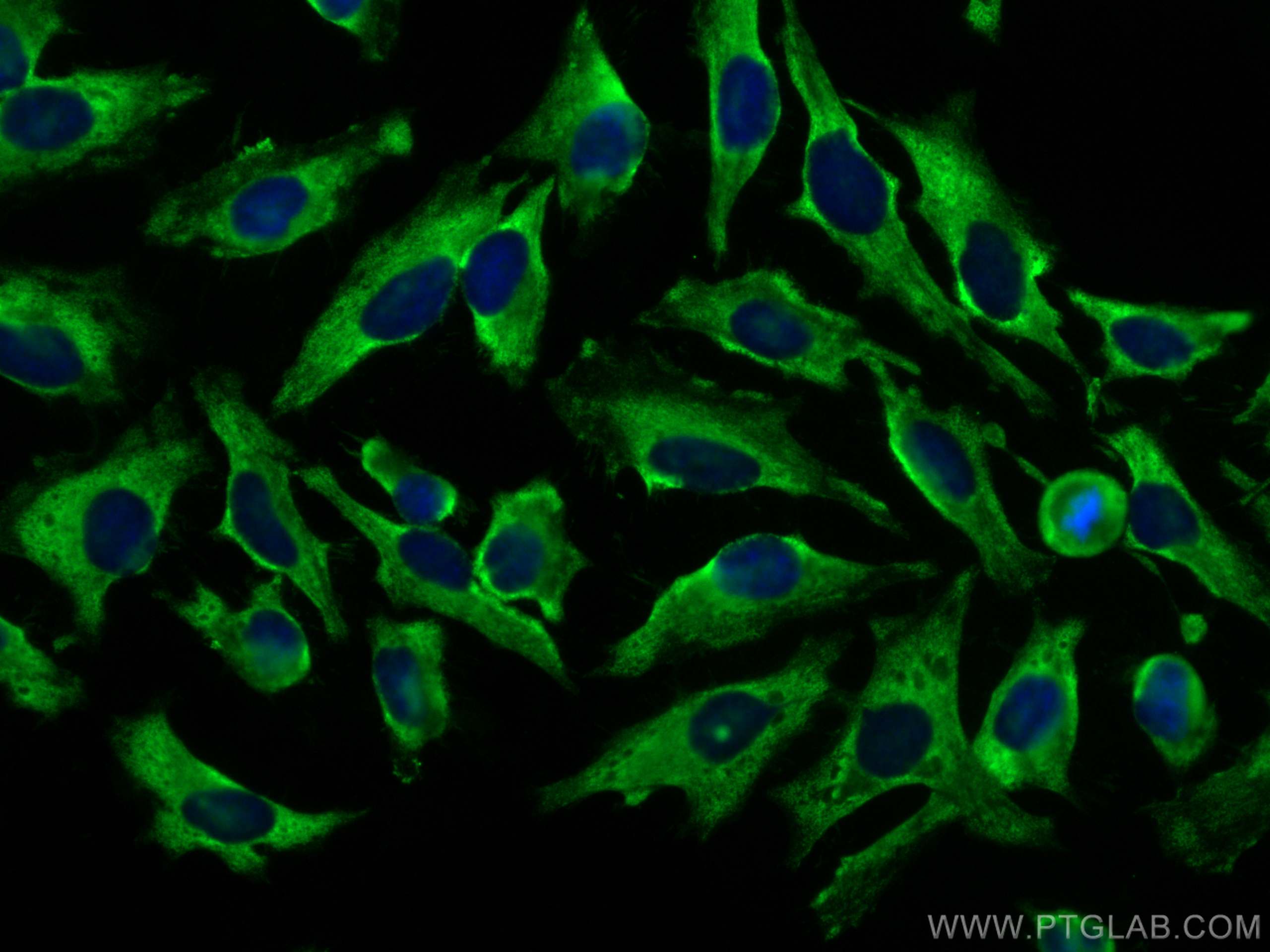 Immunofluorescence (IF) / fluorescent staining of HeLa cells using CoraLite® Plus 488-conjugated Septin 8 Monoclonal  (CL488-66188)