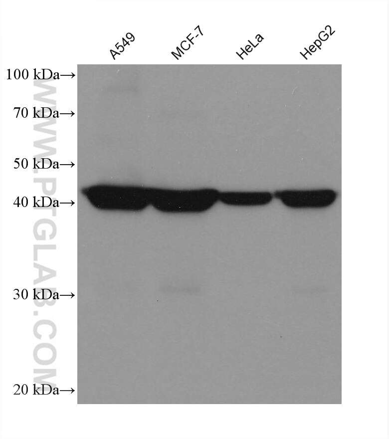 Western Blot (WB) analysis of various lysates using Septin 9 Monoclonal antibody (67548-1-Ig)