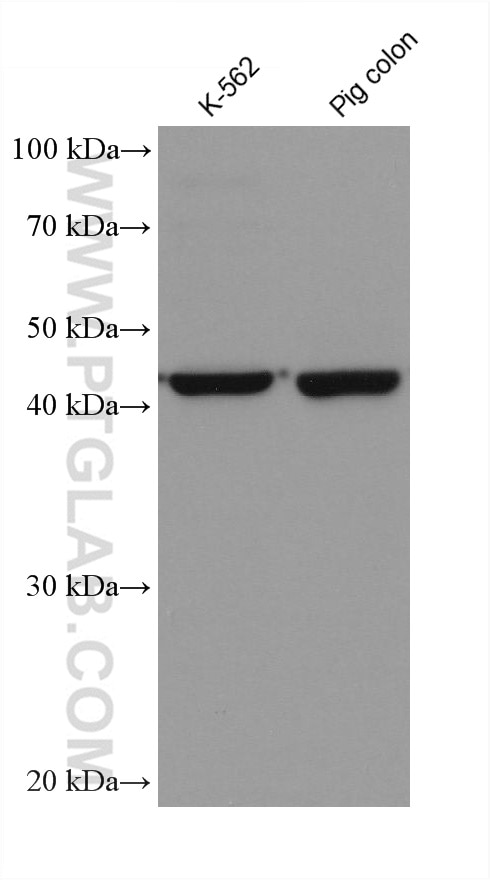 Western Blot (WB) analysis of various lysates using Septin 9 Monoclonal antibody (67548-1-Ig)