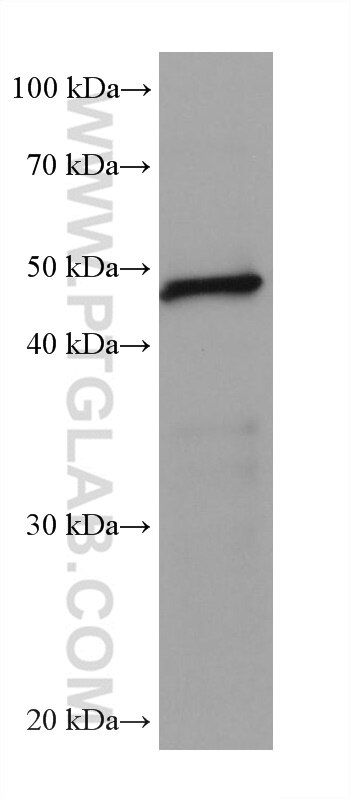 Western Blot (WB) analysis of rat colon tissue using Septin 9 Monoclonal antibody (67548-1-Ig)