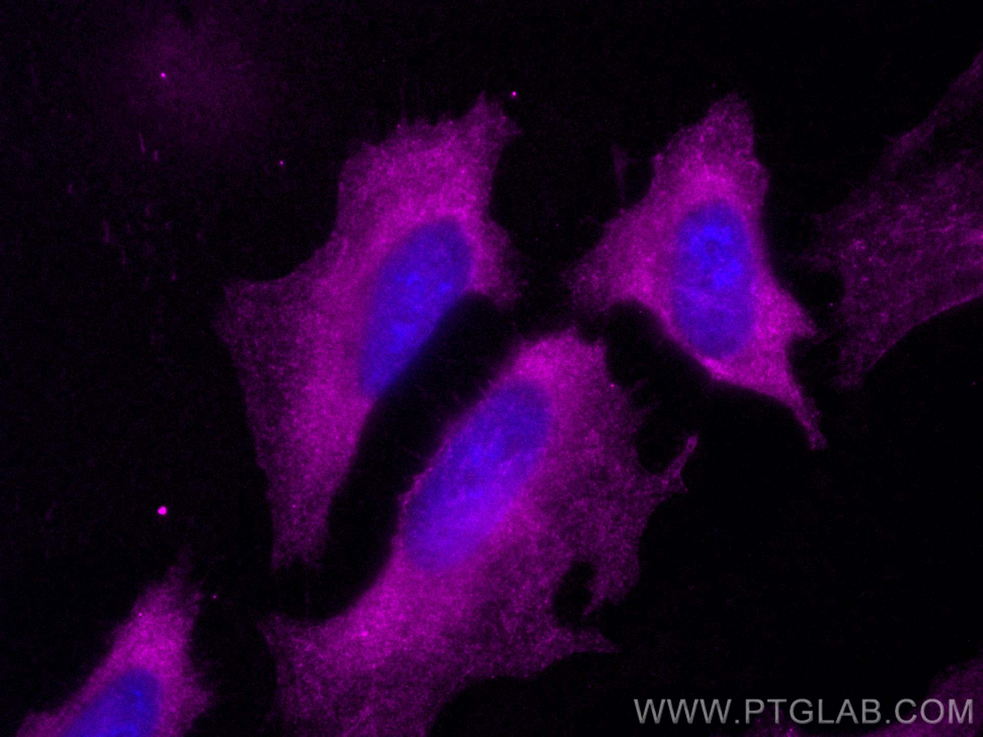 Immunofluorescence (IF) / fluorescent staining of HeLa cells using CoraLite® Plus 647-conjugated Septin 9 Polyclonal  (CL647-10769)