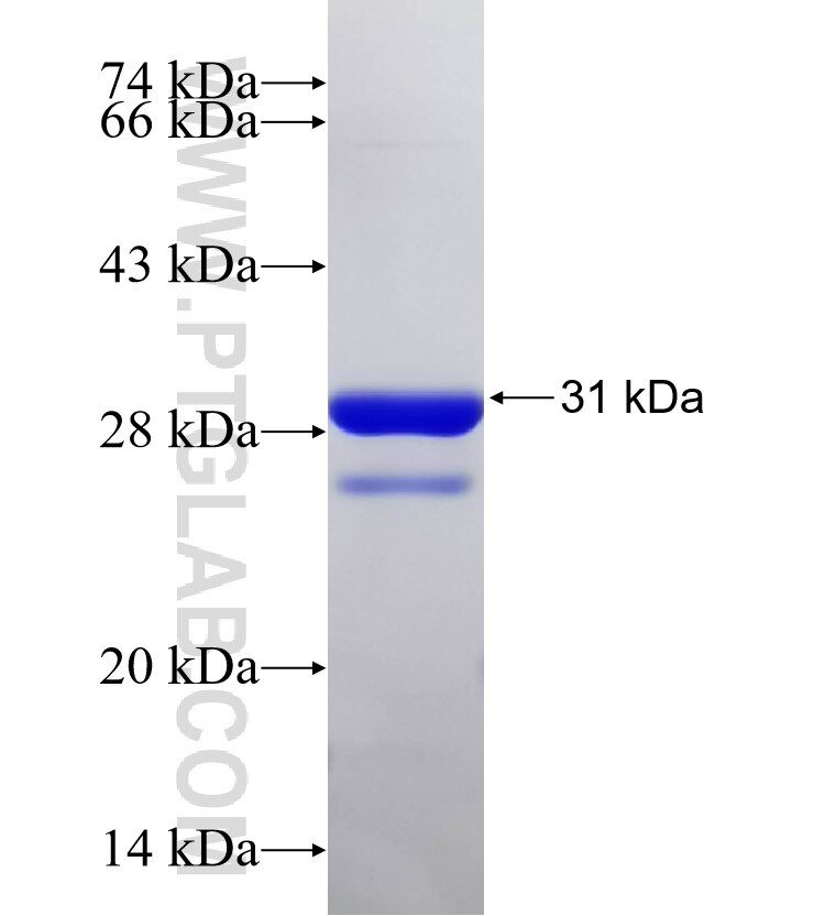 Serine fusion protein Ag32753 SDS-PAGE Serine fusion protein Ag32753 SDS-PAGE