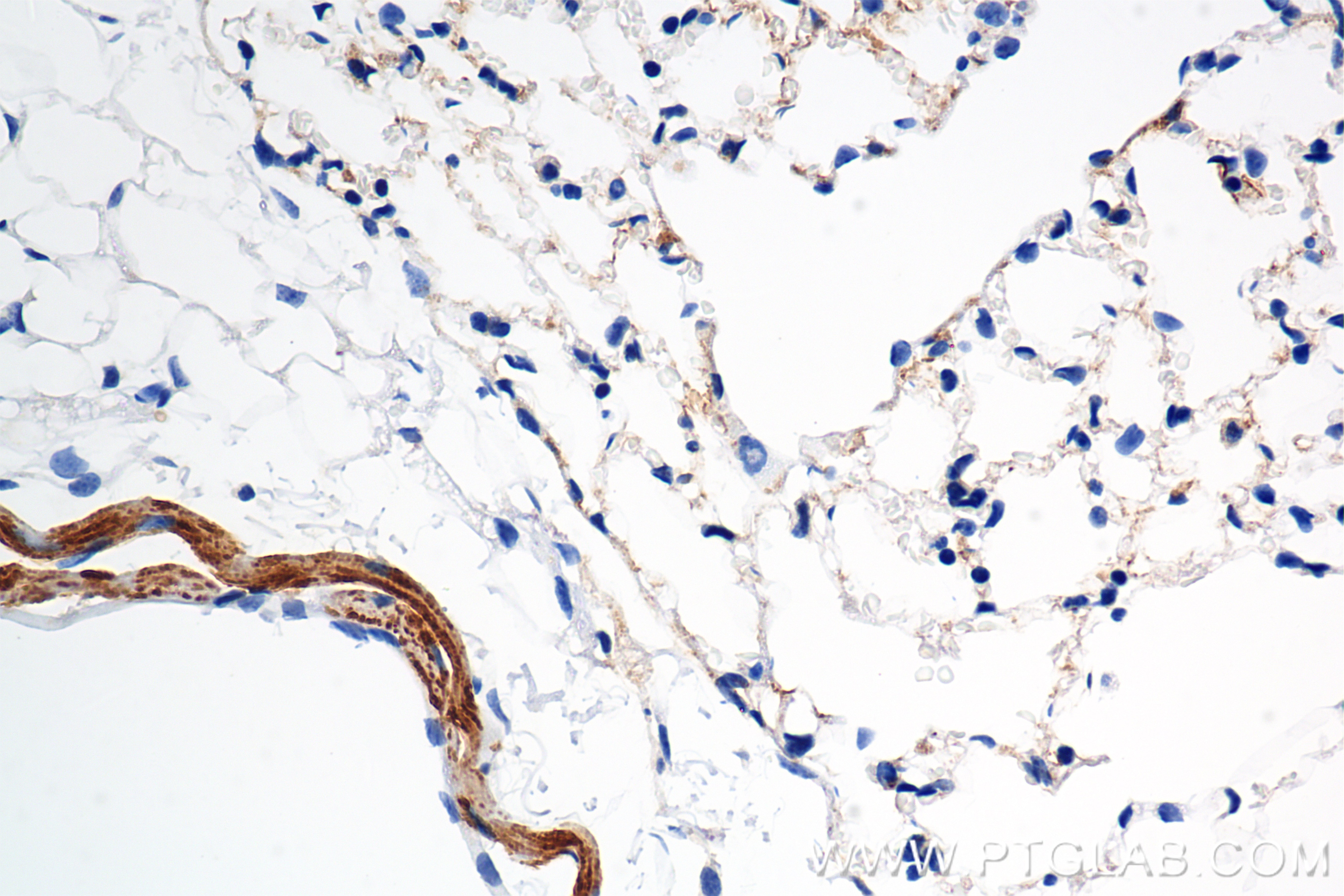 Immunohistochemistry (IHC) staining of mouse lung tissue using Serotonin transporter Recombinant monoclonal antib (84844-3-RR)