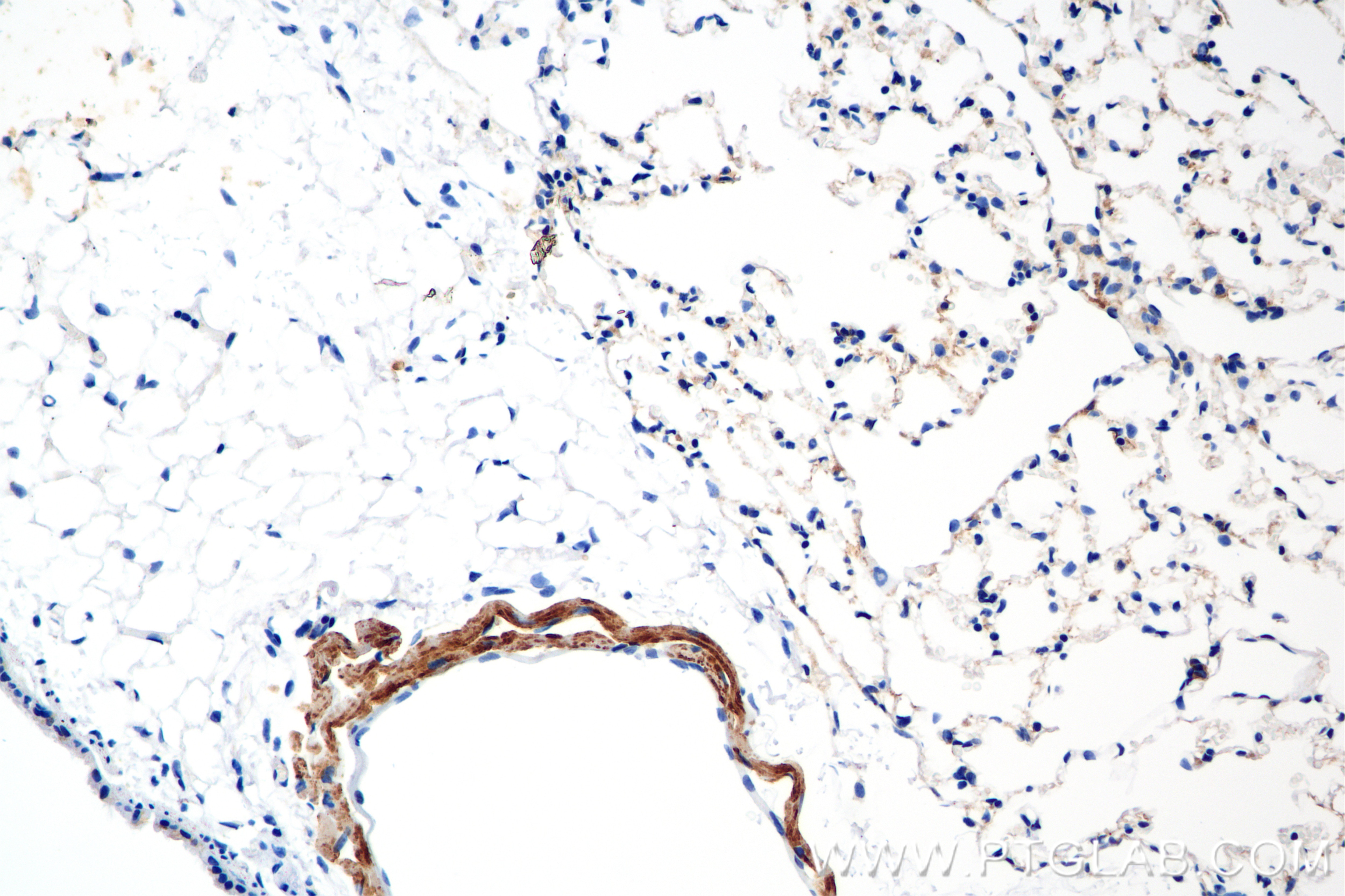 Immunohistochemistry (IHC) staining of mouse lung tissue using Serotonin transporter Recombinant antibody (84844-3-RR)