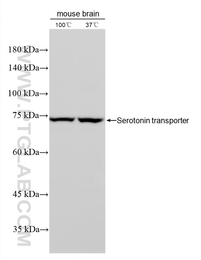 Western Blot (WB) analysis of mouse brain tissue using Serotonin transporter Recombinant monoclonal antib (84844-3-RR)