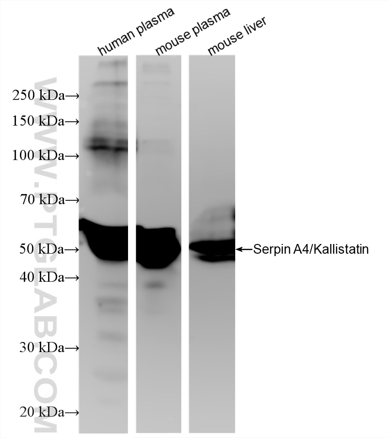 WB analysis using 86758-1-RR Western Blot (WB) analysis of various lysates using Serpin A4/Kallistatin Recombinant monoclonal antib (86758-1-RR)