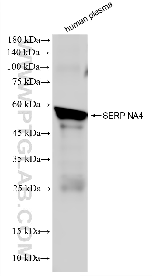 Western Blot (WB) analysis of human plasma using Serpin A4/Kallistatin Recombinant monoclonal antib (86758-3-RR)