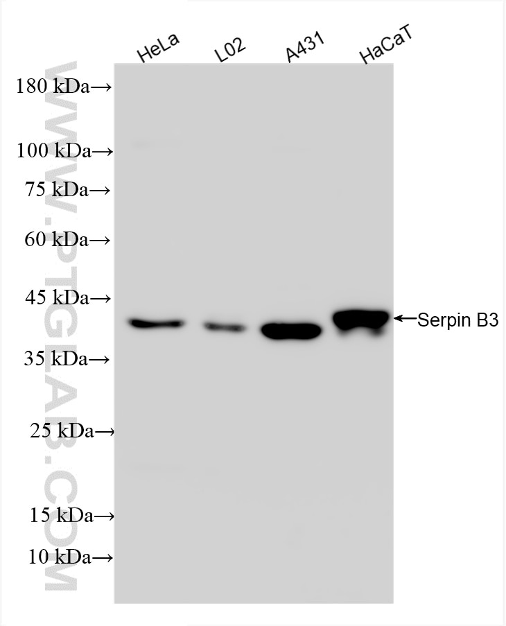 Western Blot (WB) analysis of various lysates using Serpin B3/4 Recombinant antibody (85807-2-RR)