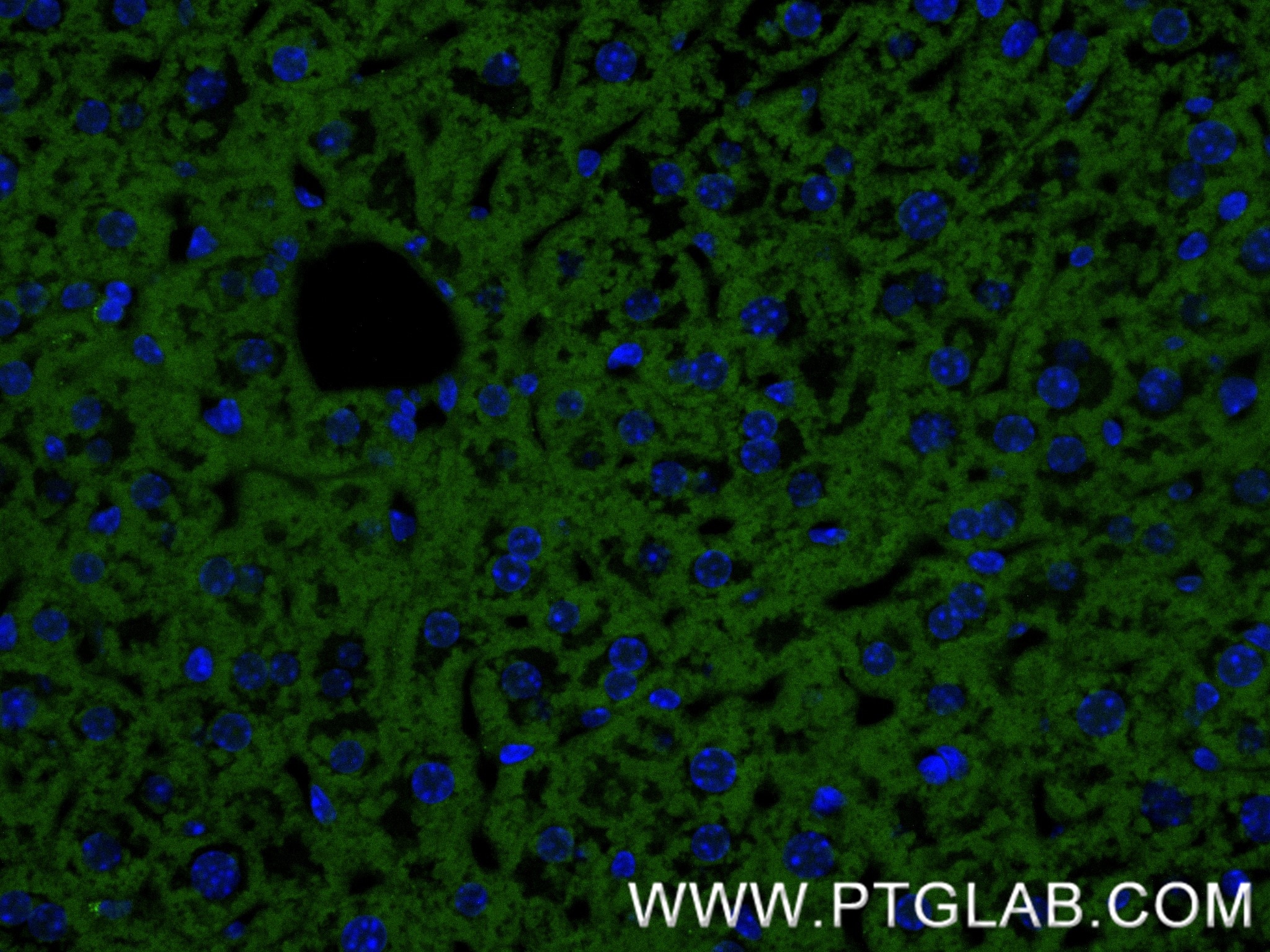 IF Staining of mouse liver using 86067-4-RR Immunofluorescence (IF) / fluorescent staining of mouse liver tissue using Serpin C1/Antithrombin III Recombinant monoclonal (86067-4-RR)