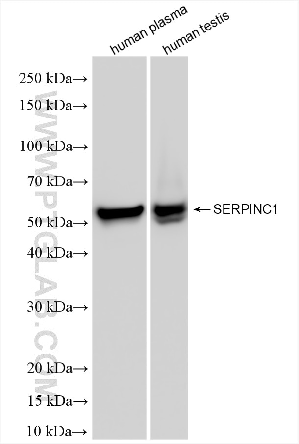 Western Blot (WB) analysis of various lysates using Serpin C1/Antithrombin III Recombinant antibody (86067-4-RR)