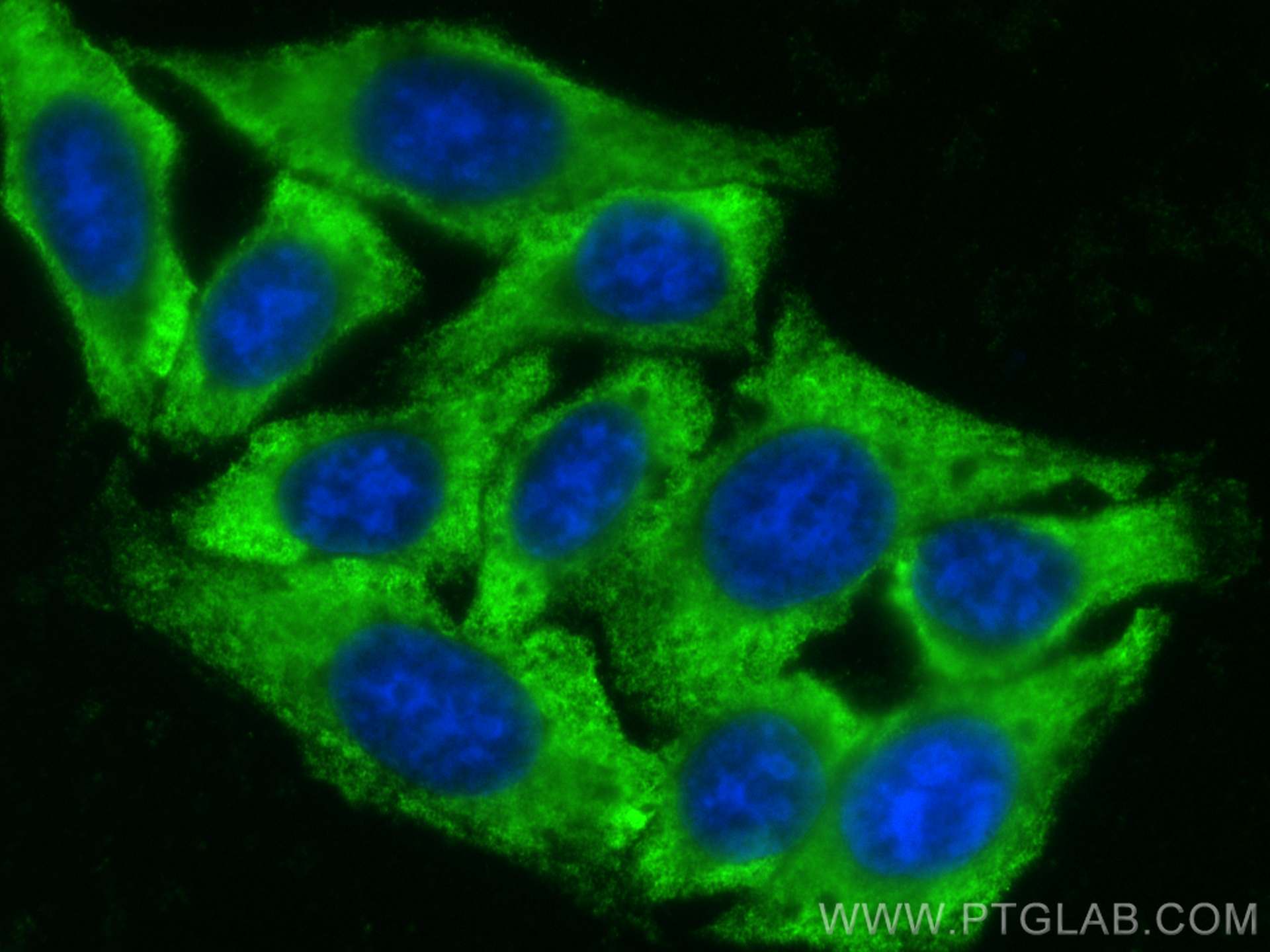 Serpin C1/Antithrombin III