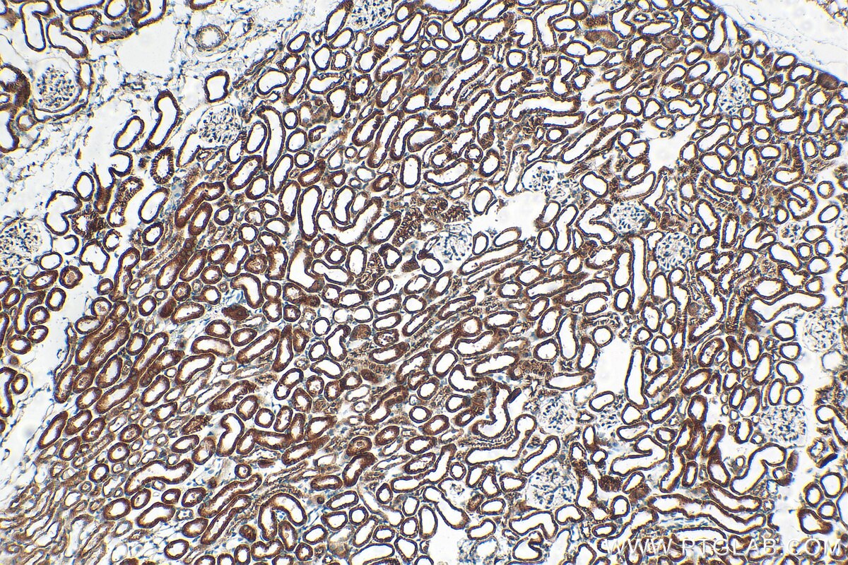 Immunohistochemistry (IHC) staining of mouse kidney tissue using Serpina3g Polyclonal antibody (55353-1-AP)