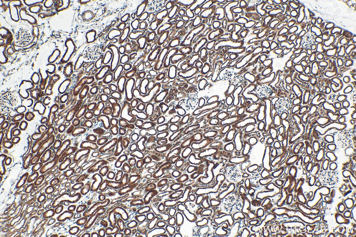 IHC staining of mouse kidney using 55353-1-AP