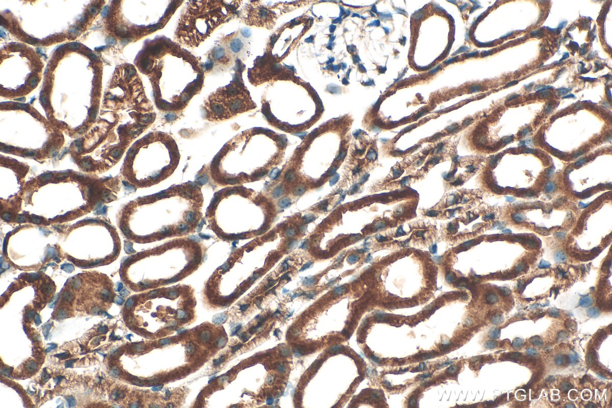 Immunohistochemistry (IHC) staining of mouse kidney tissue using Serpina3g Polyclonal antibody (55353-1-AP)