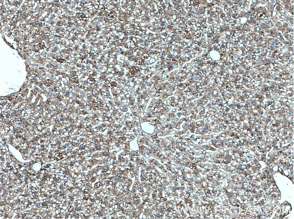 Immunohistochemistry (IHC) staining of mouse liver tissue using Serpina3k Polyclonal antibody (55480-1-AP)