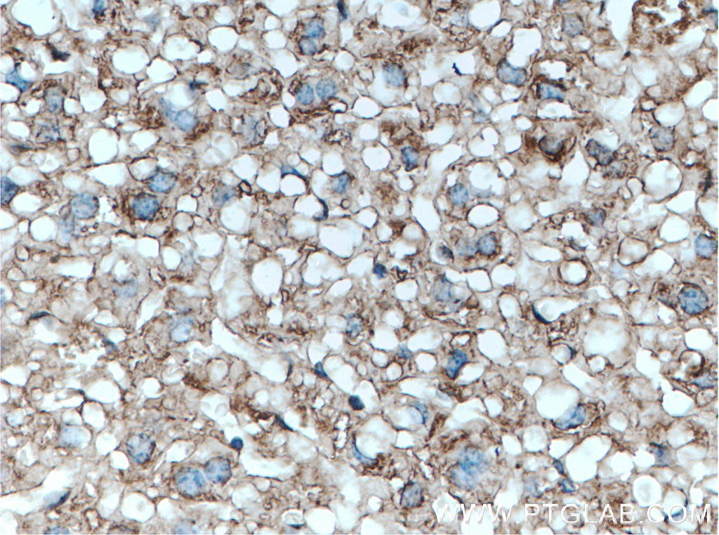 Immunohistochemistry (IHC) staining of mouse liver tissue using Serpina3k Polyclonal antibody (55480-1-AP)