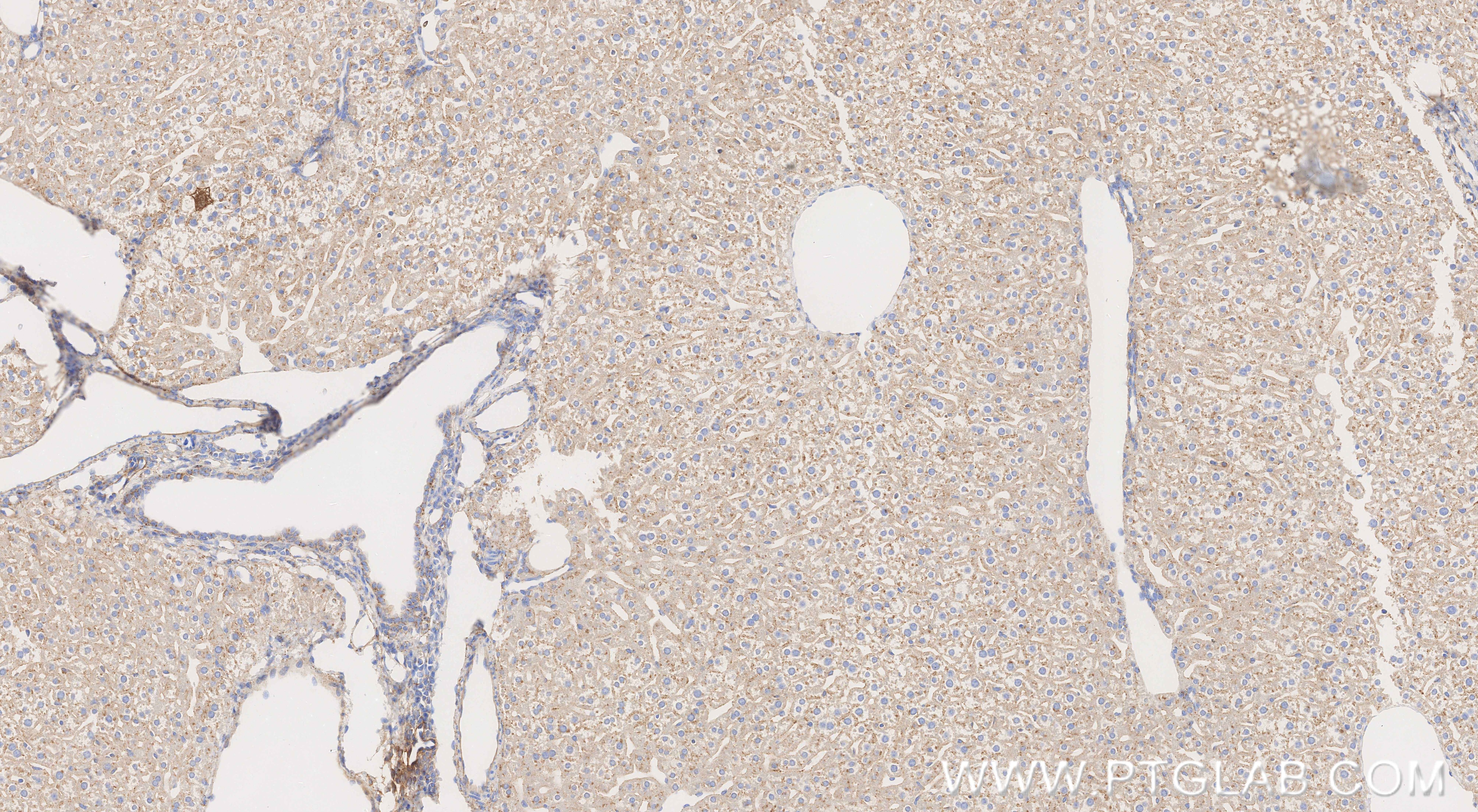 Immunohistochemistry (IHC) staining of mouse liver tissue using Serpinc1 Recombinant monoclonal antibody (86029-1-RR)