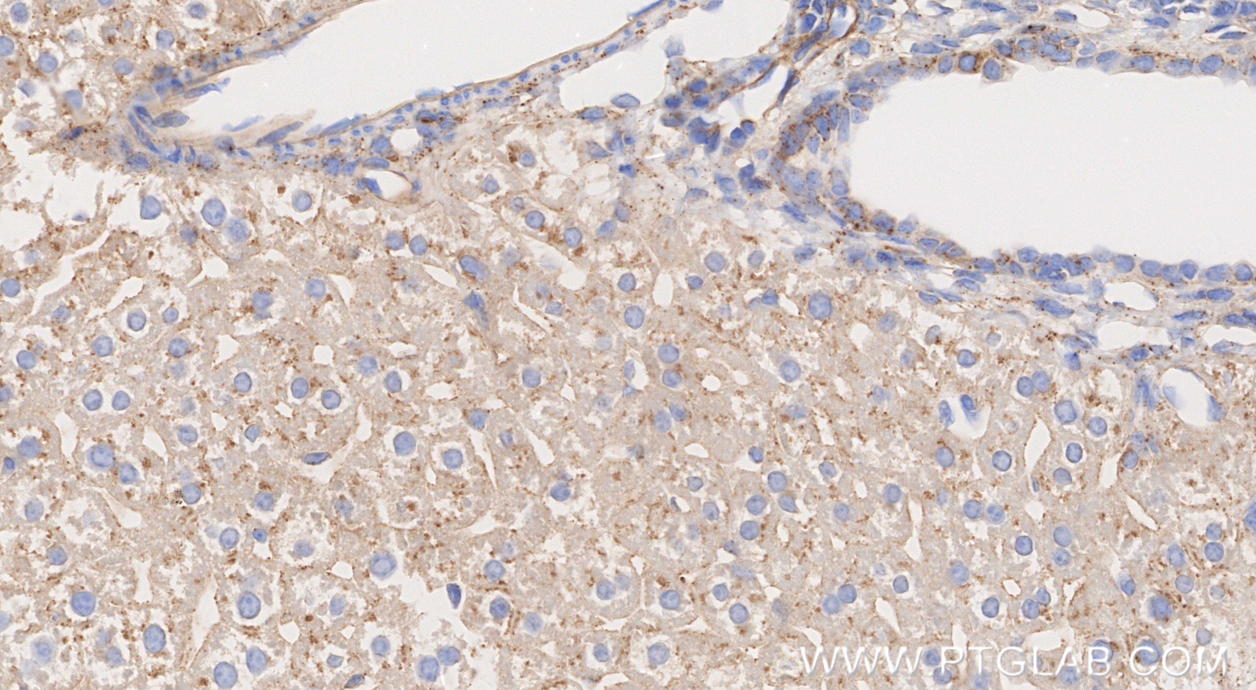 Immunohistochemistry (IHC) staining of mouse liver tissue using Serpinc1 Recombinant monoclonal antibody (86029-1-RR)