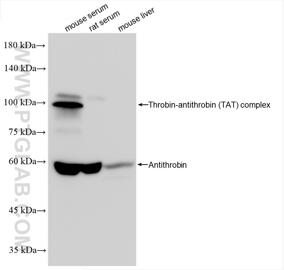 Western Blot (WB) analysis of various lysates using Serpinc1 Recombinant antibody (86029-1-RR)