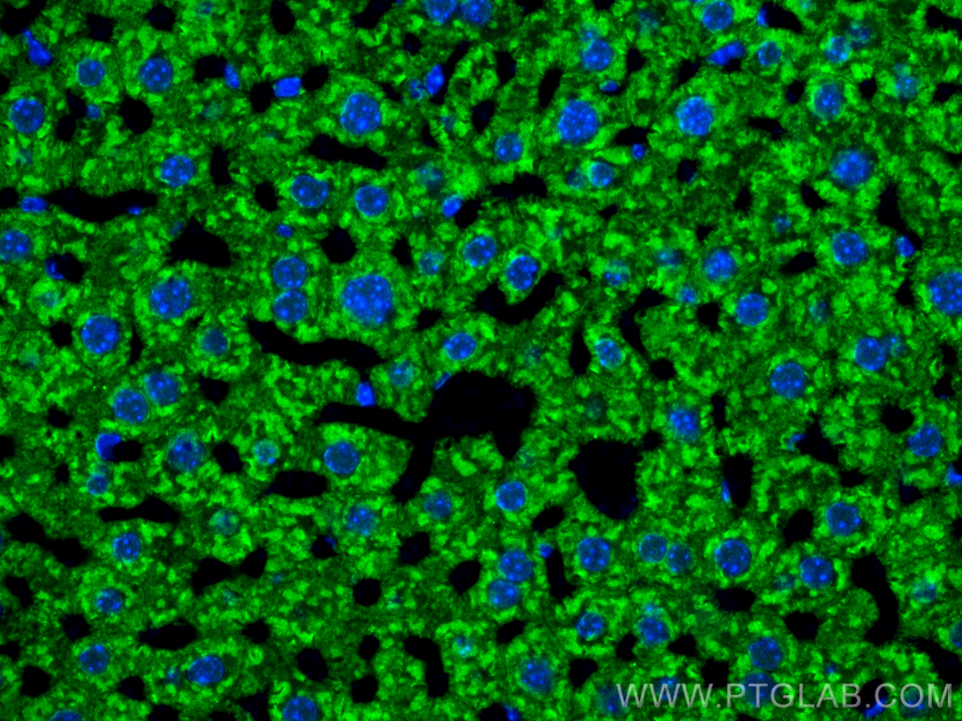 Immunofluorescence (IF) / fluorescent staining of mouse liver tissue using Serum amyloid P component Polyclonal antibody (31813-1-AP)