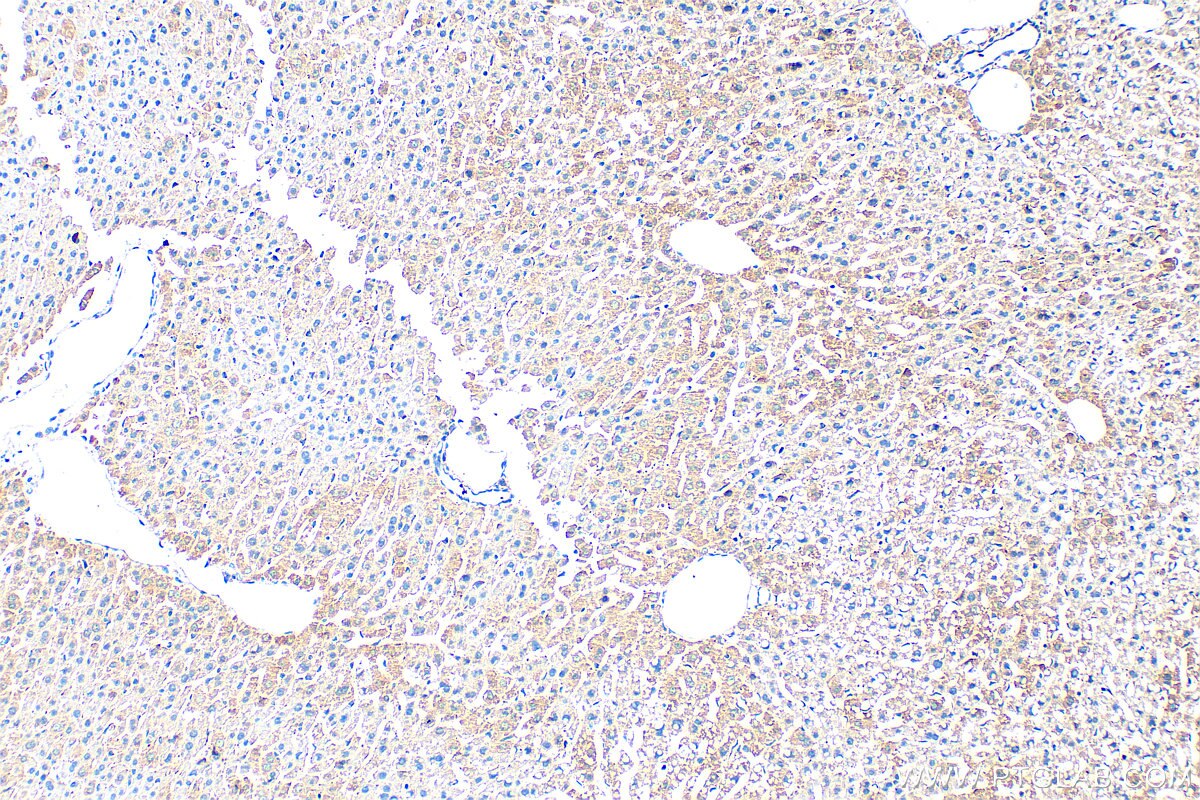 Immunohistochemistry (IHC) staining of mouse liver tissue using Serum amyloid P component Polyclonal antibody (31813-1-AP)