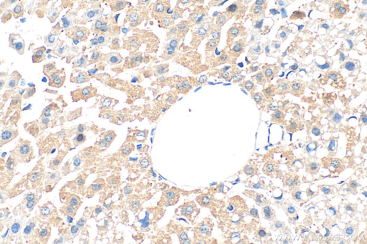 Immunohistochemistry (IHC) staining of mouse liver tissue using Serum amyloid P component Polyclonal antibody (31813-1-AP)