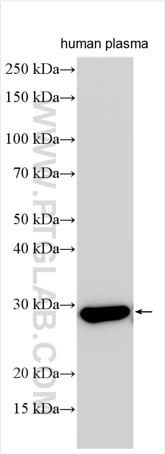 Western Blot (WB) analysis of various lysates using Serum amyloid P component Polyclonal antibody (31813-1-AP)