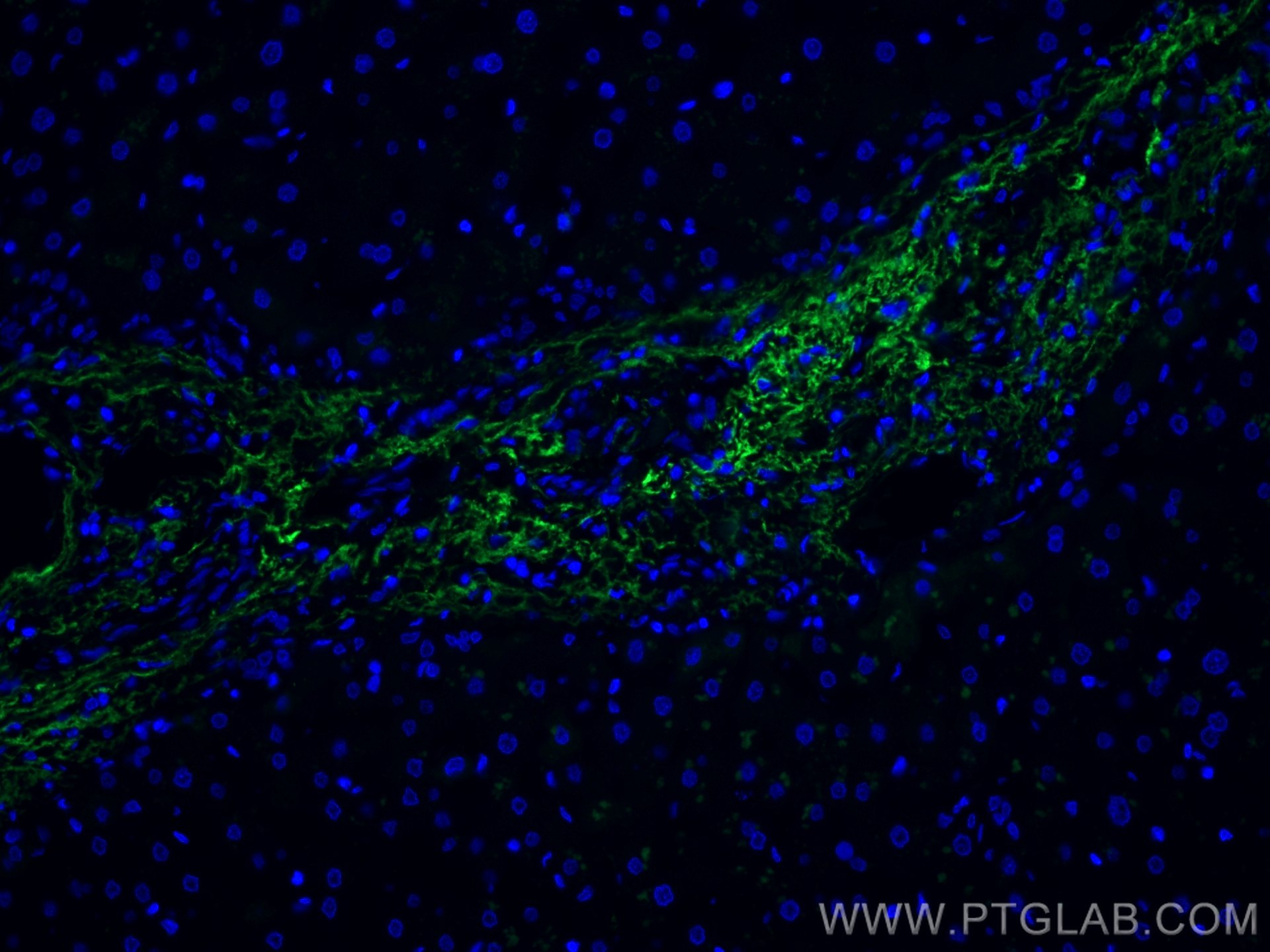 Immunofluorescence (IF) / fluorescent staining of human liver tissue using CoraLite® Plus 488-conjugated Serum amyloid P comp (CL488-66084)