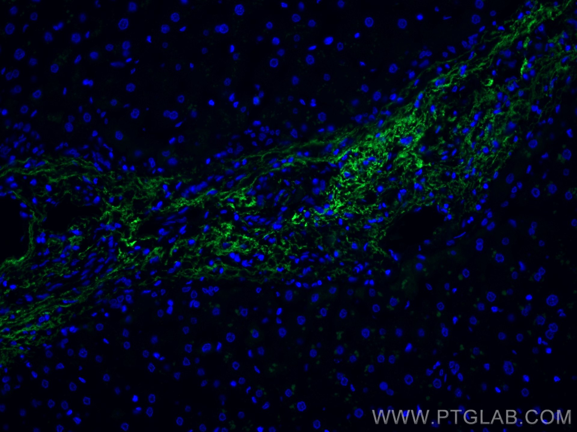 IF Staining of human liver using CL488-66084