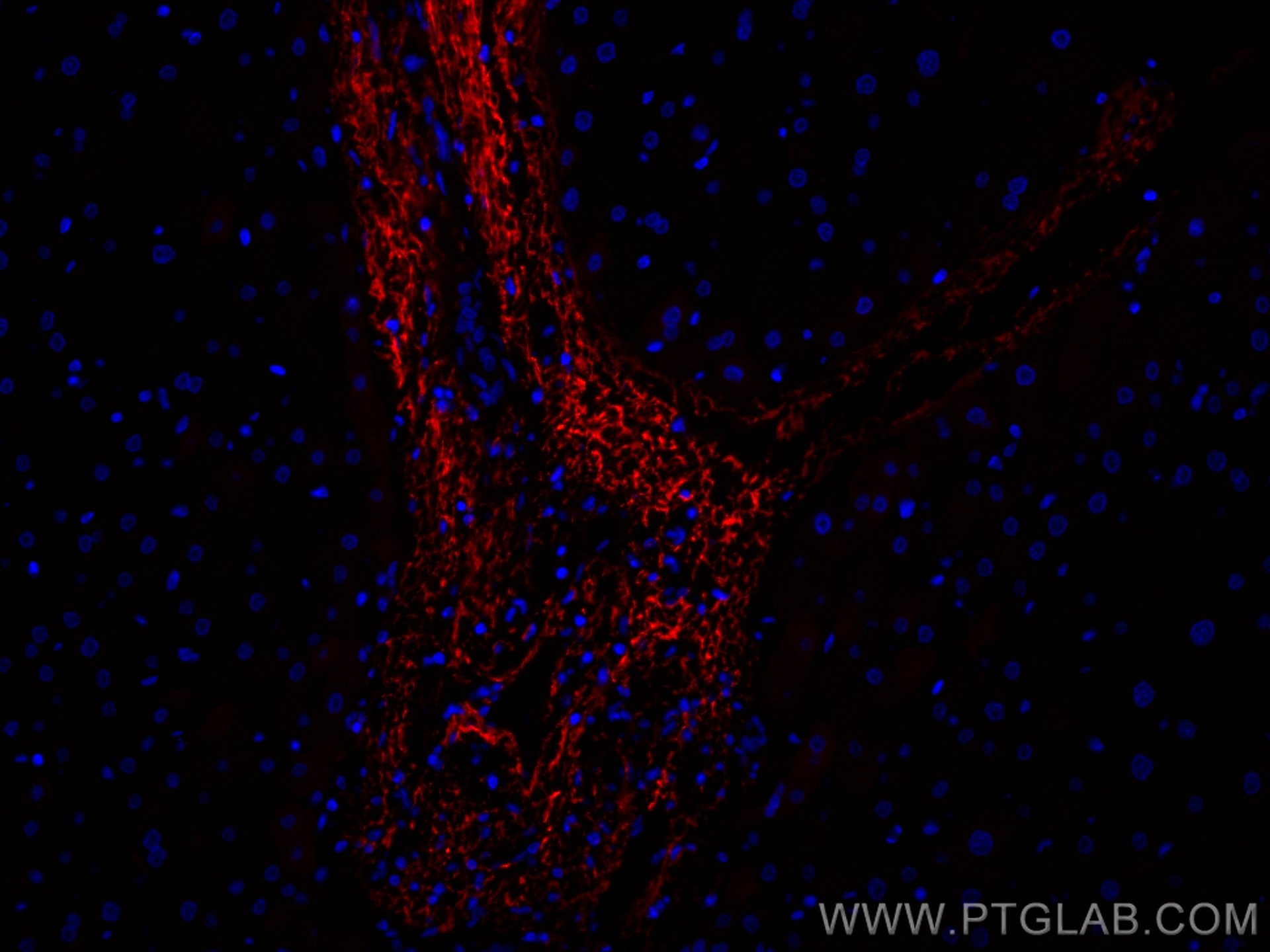 Immunofluorescence (IF) / fluorescent staining of human liver tissue using CoraLite®594-conjugated Serum amyloid P component  (CL594-66084)