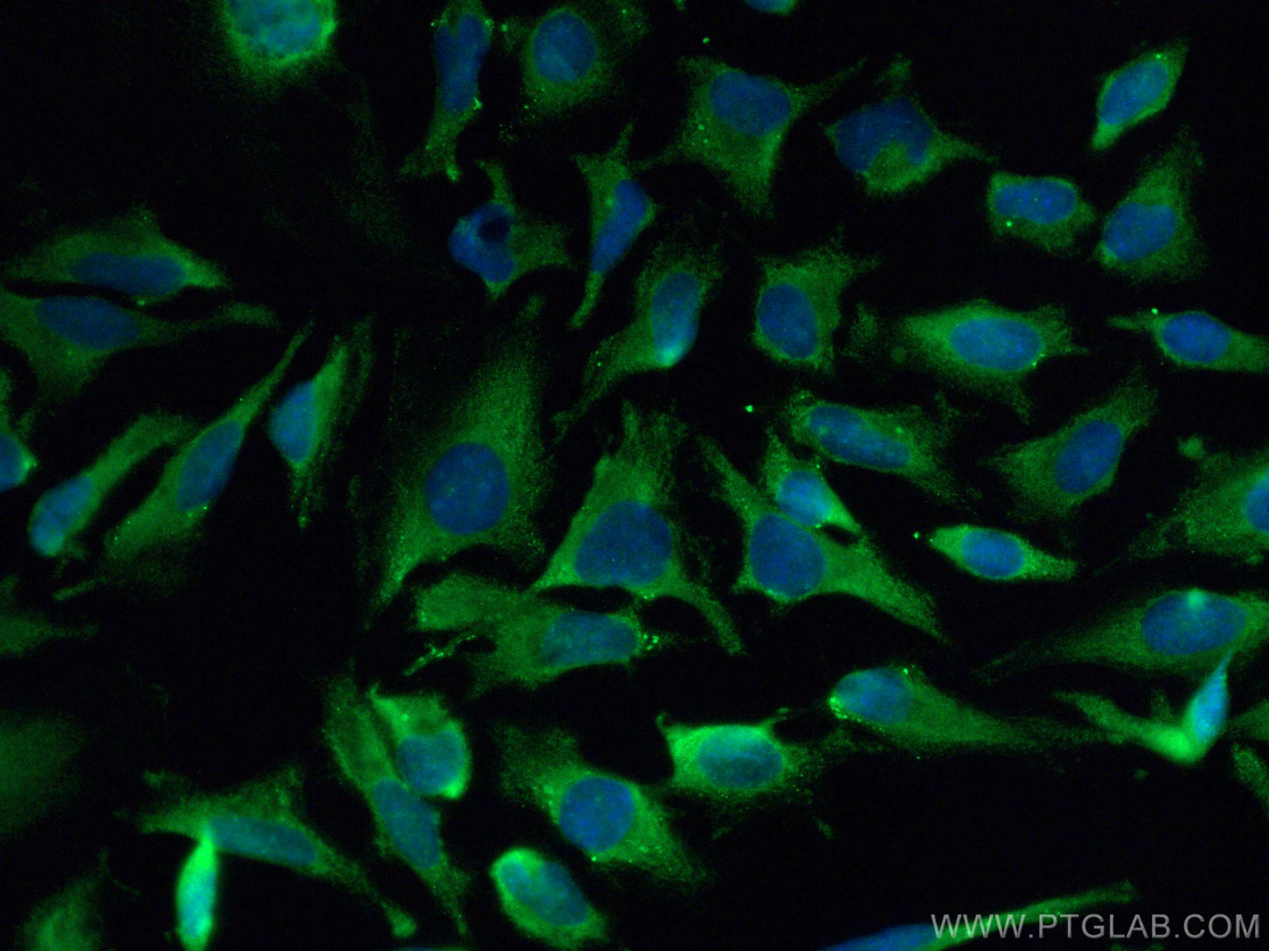 Immunofluorescence (IF) / fluorescent staining of HeLa cells using CoraLite® Plus 488-conjugated Sestrin 2 Polyclonal (CL488-10795)