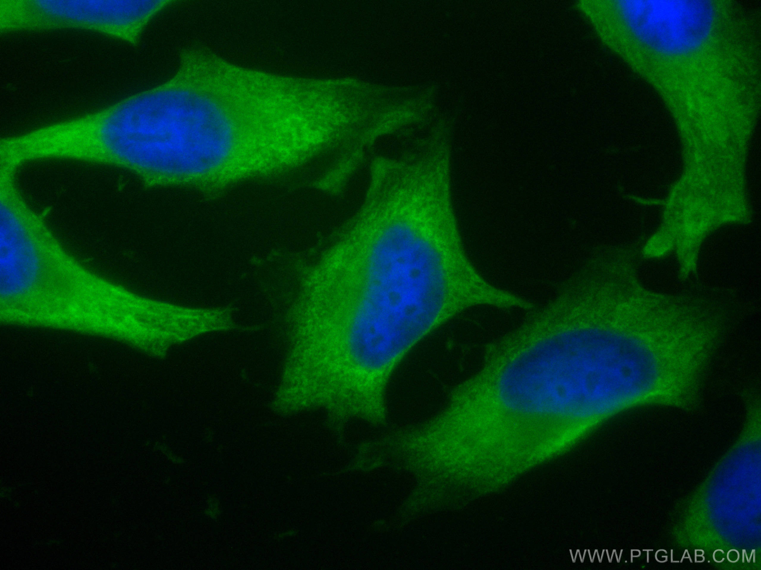 Immunofluorescence (IF) / fluorescent staining of HeLa cells using CoraLite® Plus 488-conjugated Sestrin 2 Monoclonal (CL488-66297)