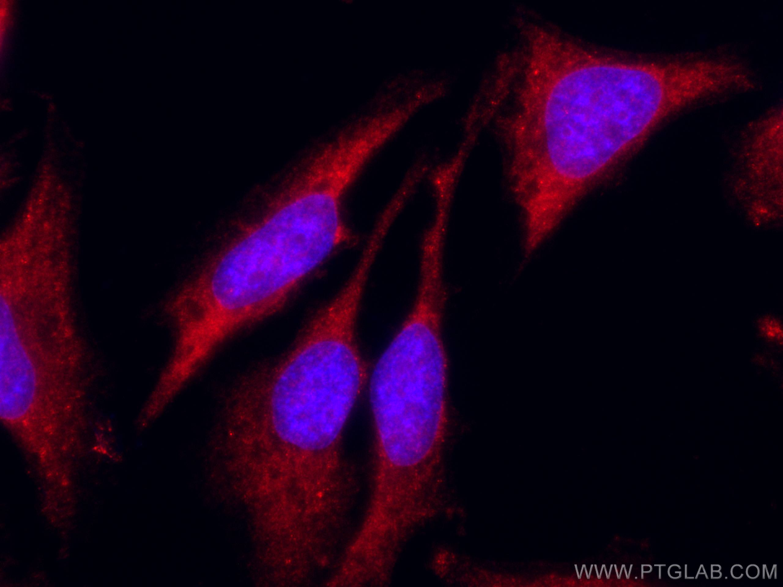 Immunofluorescence (IF) / fluorescent staining of HeLa cells using CoraLite®594-conjugated Sestrin 2 Polyclonal antib (CL594-10795)