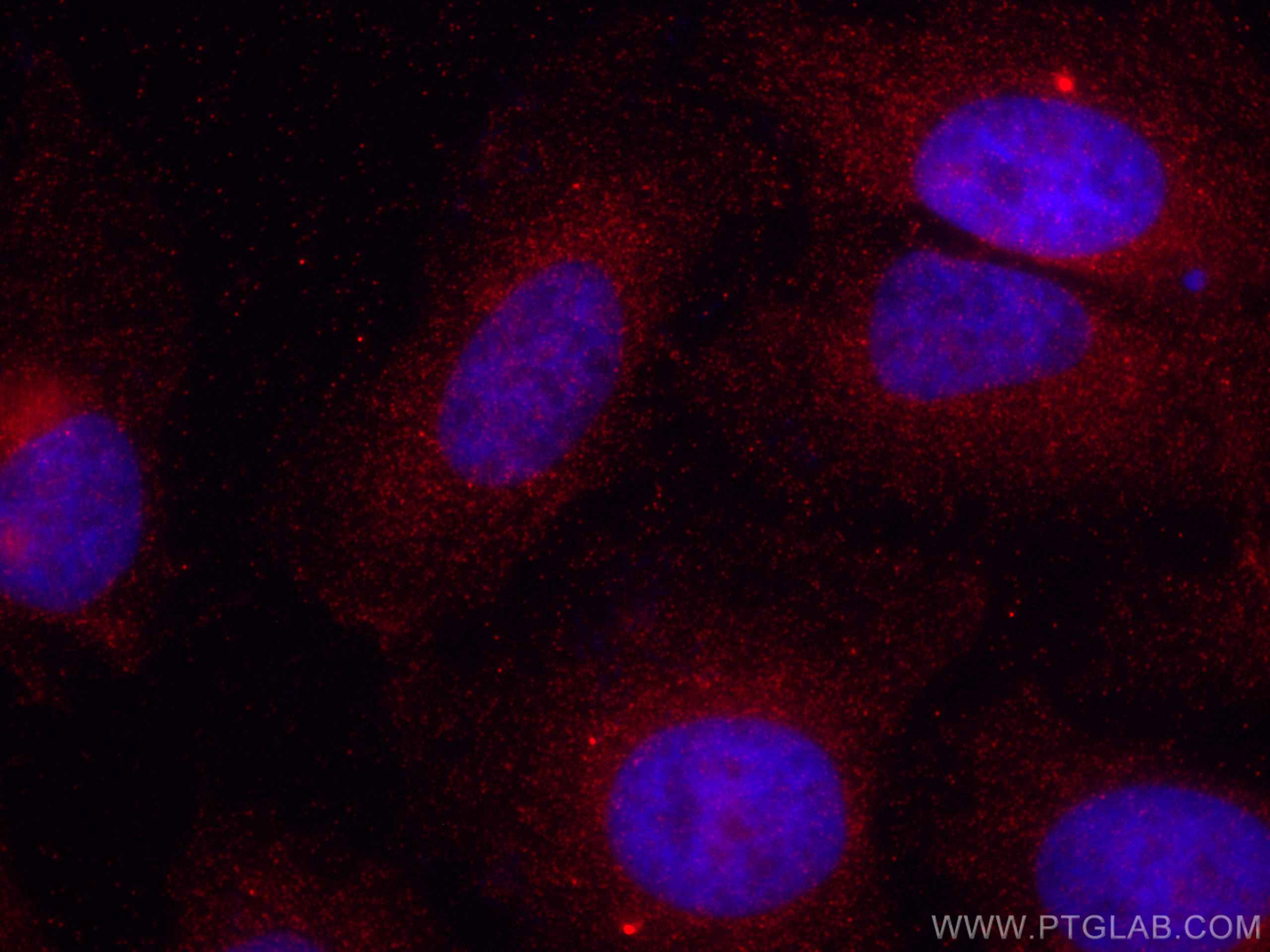 Immunofluorescence (IF) / fluorescent staining of HeLa cells using CoraLite®594-conjugated Sestrin 2 Monoclonal antib (CL594-66297)