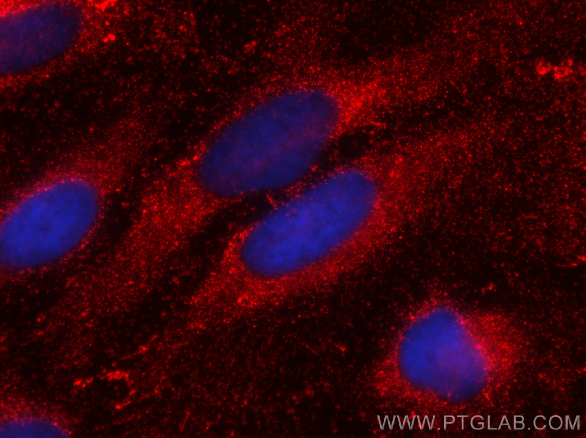 Immunofluorescence (IF) / fluorescent staining of HeLa cells using CoraLite®594-conjugated Sestrin 2 Monoclonal antib (CL594-66297)