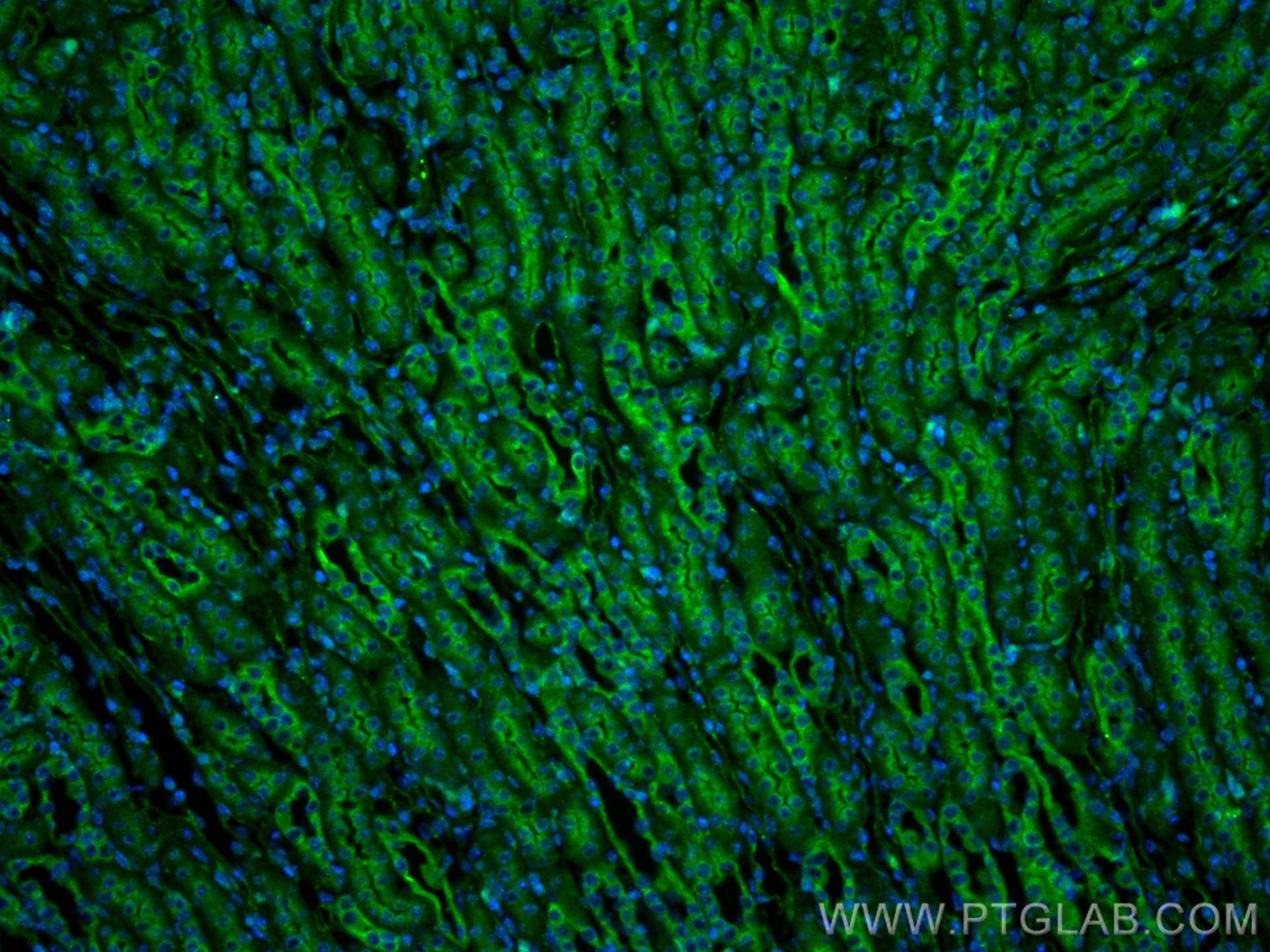 Immunofluorescence (IF) / fluorescent staining of mouse kidney tissue using Sestrin 2 Polyclonal antibody (10795-1-AP)