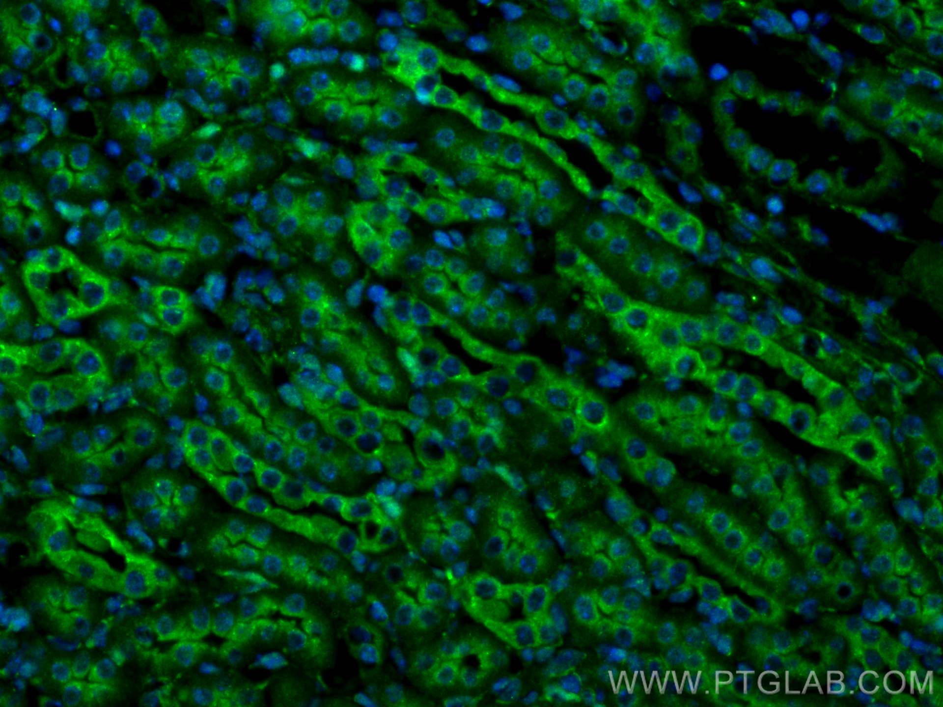 Immunofluorescence (IF) / fluorescent staining of mouse kidney tissue using Sestrin 2 Polyclonal antibody (10795-1-AP)