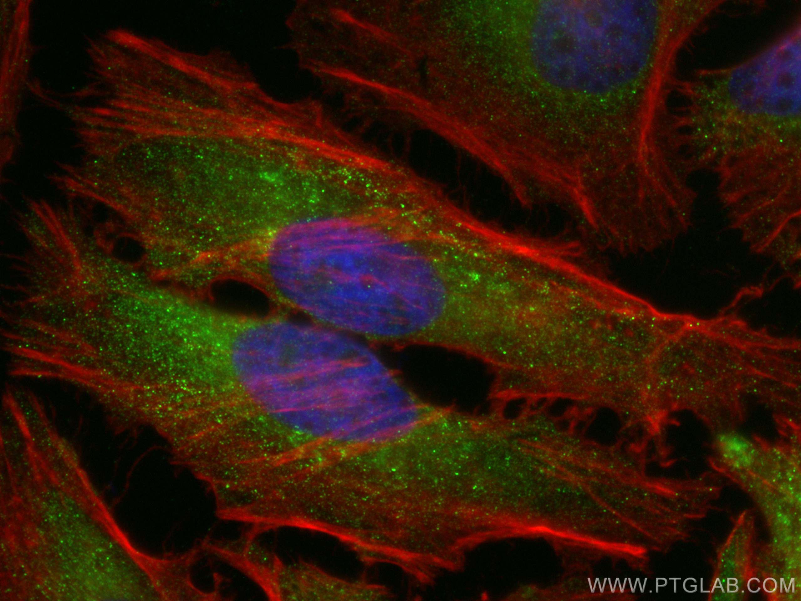 Immunofluorescence (IF) / fluorescent staining of HeLa cells using Sestrin 2 Polyclonal antibody (10795-1-AP)